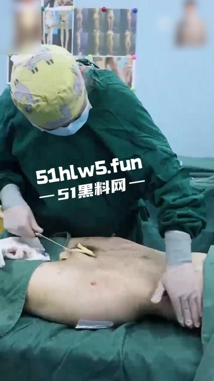 实拍整形医院，小仙女整容抽脂和填充全过程，看着残忍但做完后惊艳的效果让人震撼。